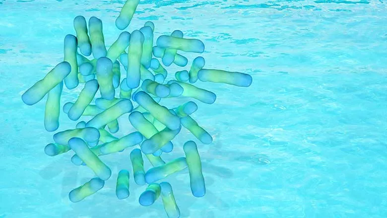 Legionella