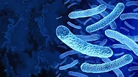 Legionella